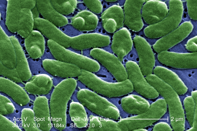 bakterie Vibrio vulnificus