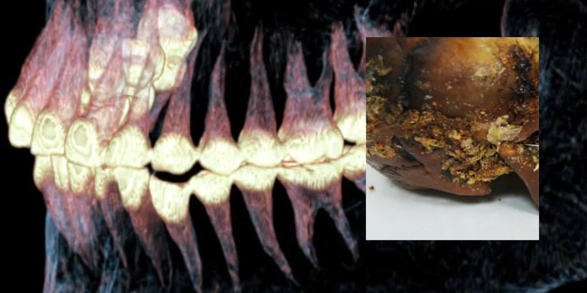 skan czaszki odkrytej na Syberii